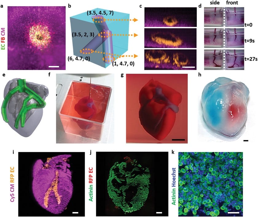Scientists printed the first 3D heart using patient cells